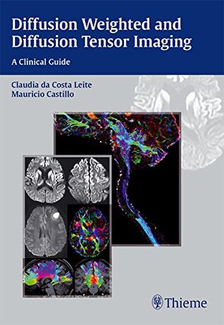 Read Diffusion Weighted and Diffusion Tensor Imaging: A Clinical Guide: A Clinical Guide - Claudia Leite file in PDF
