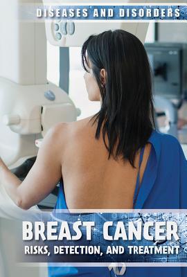Full Download Breast Cancer: Risks, Detection, and Treatment - Michelle Denton | PDF