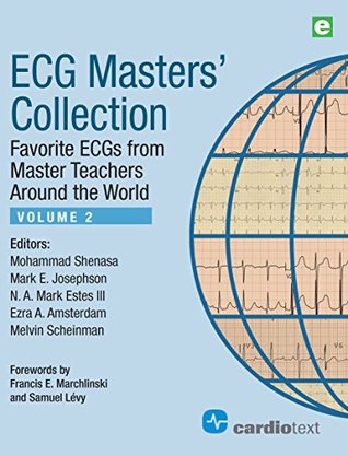 Read Online ECG Masters’ Collection Volume 2: Favorite ECGs from Master Teachers Around the World - Mohammad Shenasa file in ePub